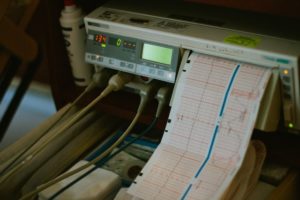 7 Reasons Why You May Need an Echocardiogram